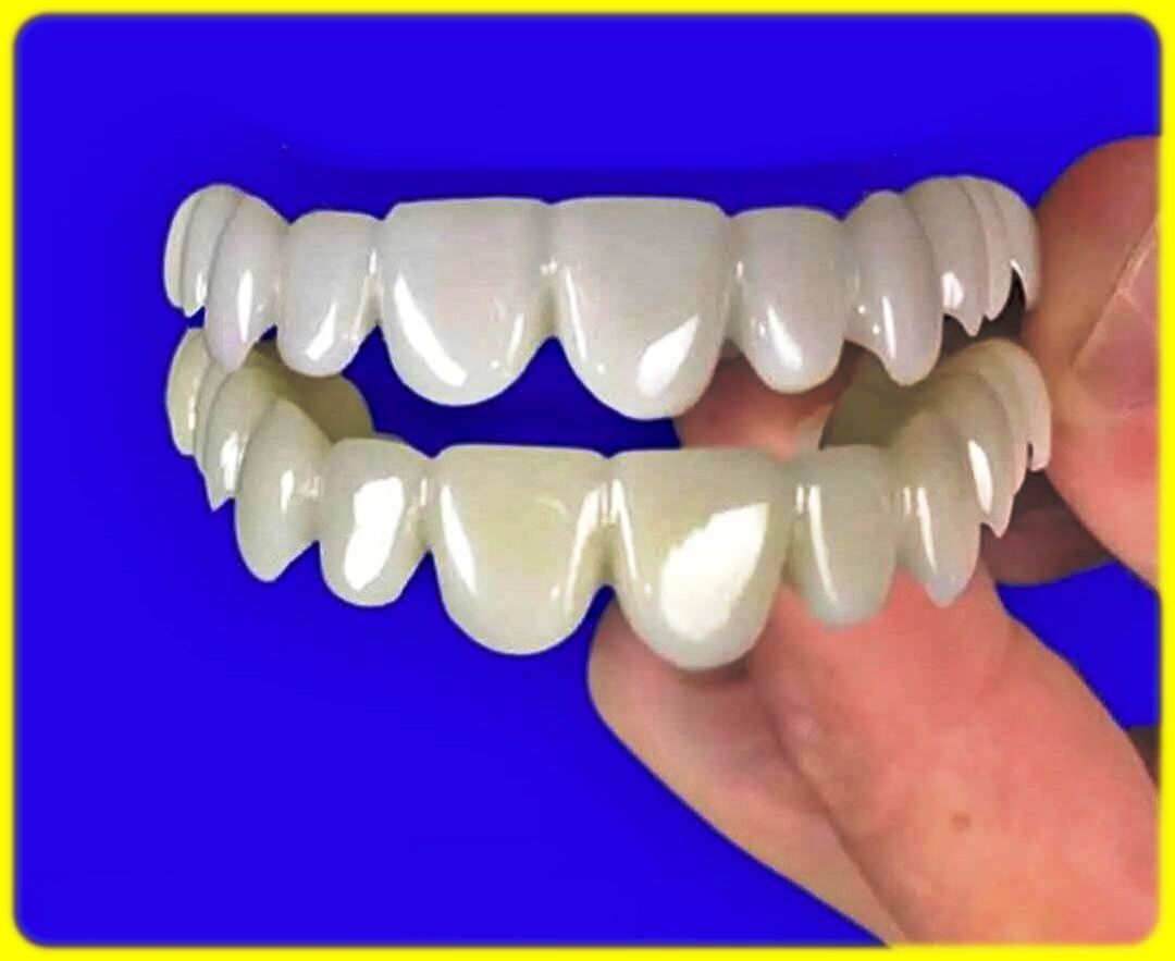 آیا میدانید هزینه لمینت متحرک دندان Snap-on Smile چقدر است؟