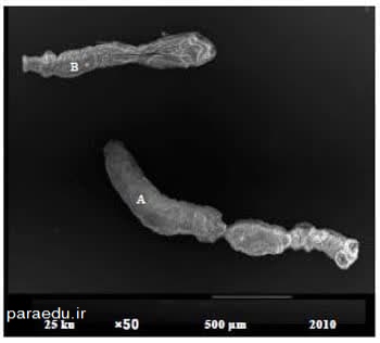 تصویر میکروسکوپ الکترونی کرم بالغ اکینوکوکوس گرانولوزوس