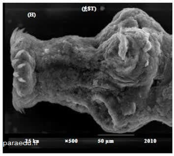 تصویر میکروسکوپ الکترونی از اسکولکس و بندهای کرم بالغ اکینوکوکوس گرانولوزوس
