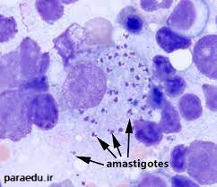 آماستیگوت لیشمانیا در نمونه زخم
leishmania amastigote