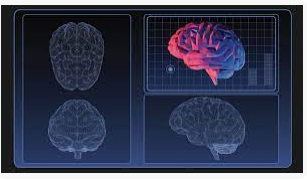 سونوگرافی داپلر عروق مغزی چه عملکردی دارد؟