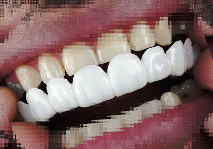 چرا داشتن دندان زیبا بسیار مهم است
